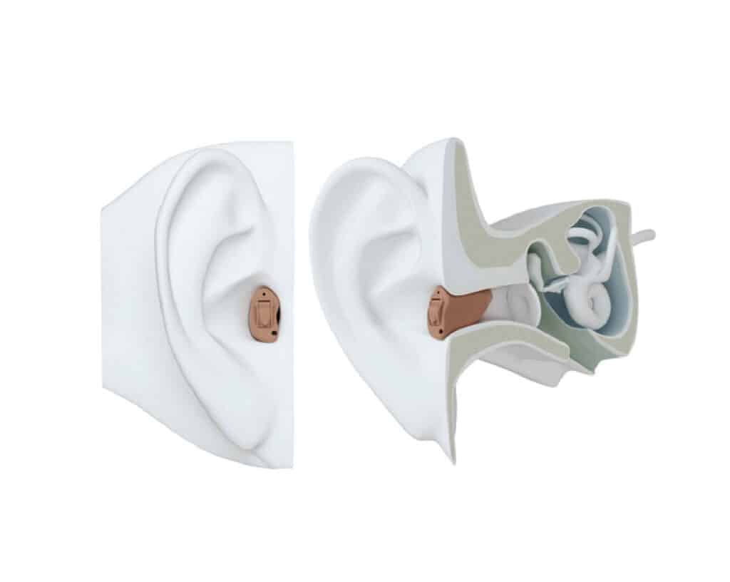 CIC custom hearing aids